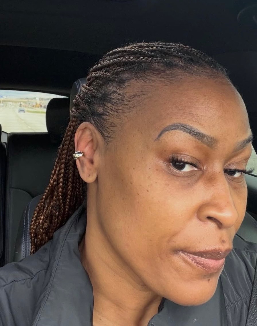 Dermaplane facial result